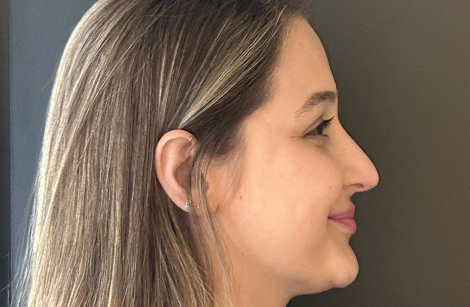 Antes - Paciente 001