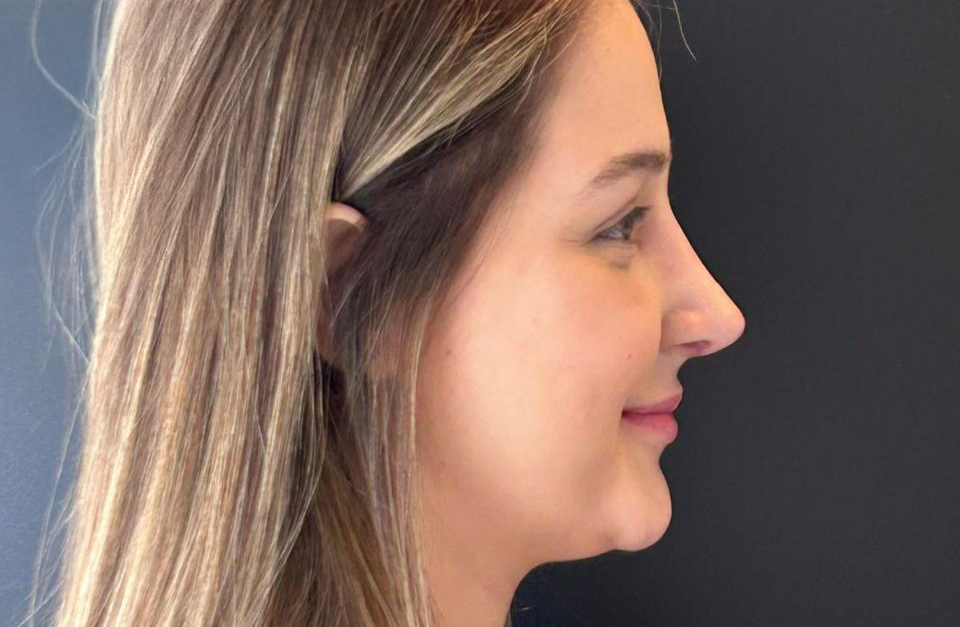 Depois - Paciente 001