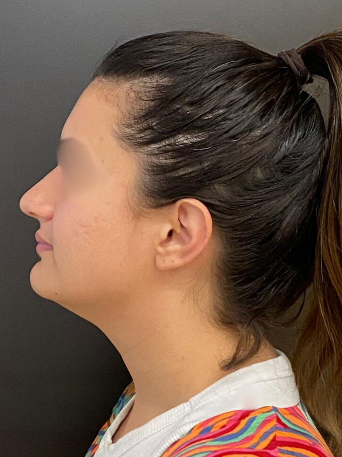 Antes - Paciente 002