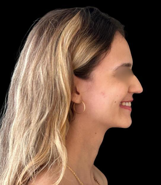 Antes - Paciente 005