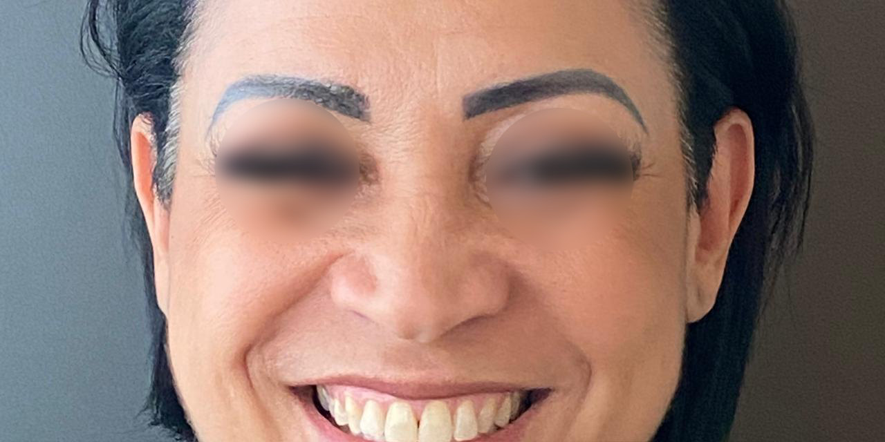 Antes - Paciente 016