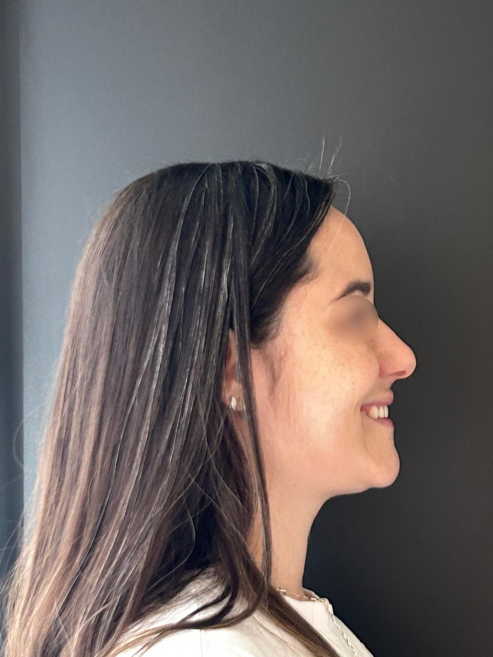 Antes - Paciente 018