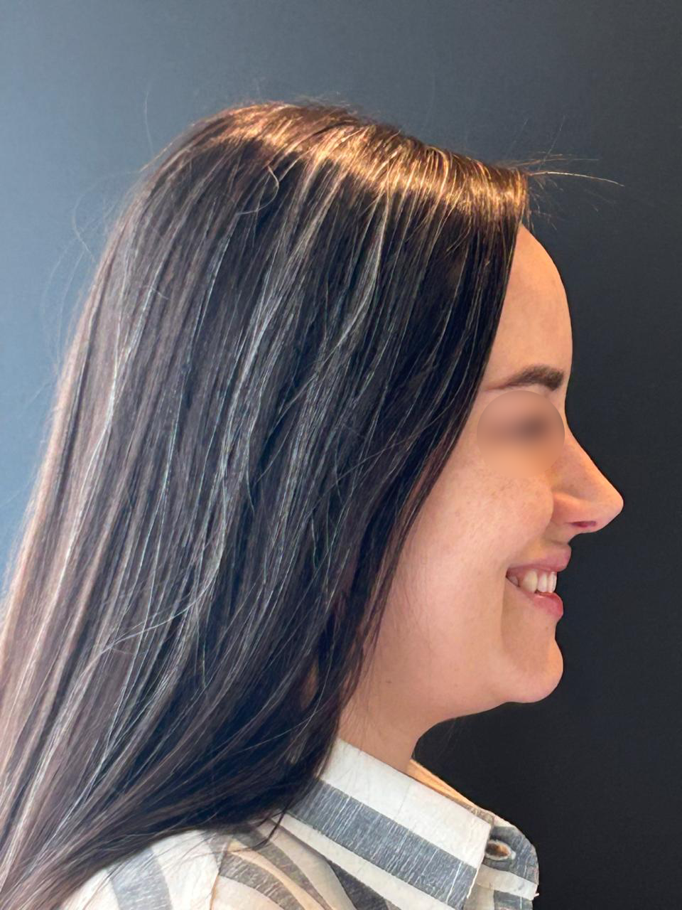 Depois - Paciente 018